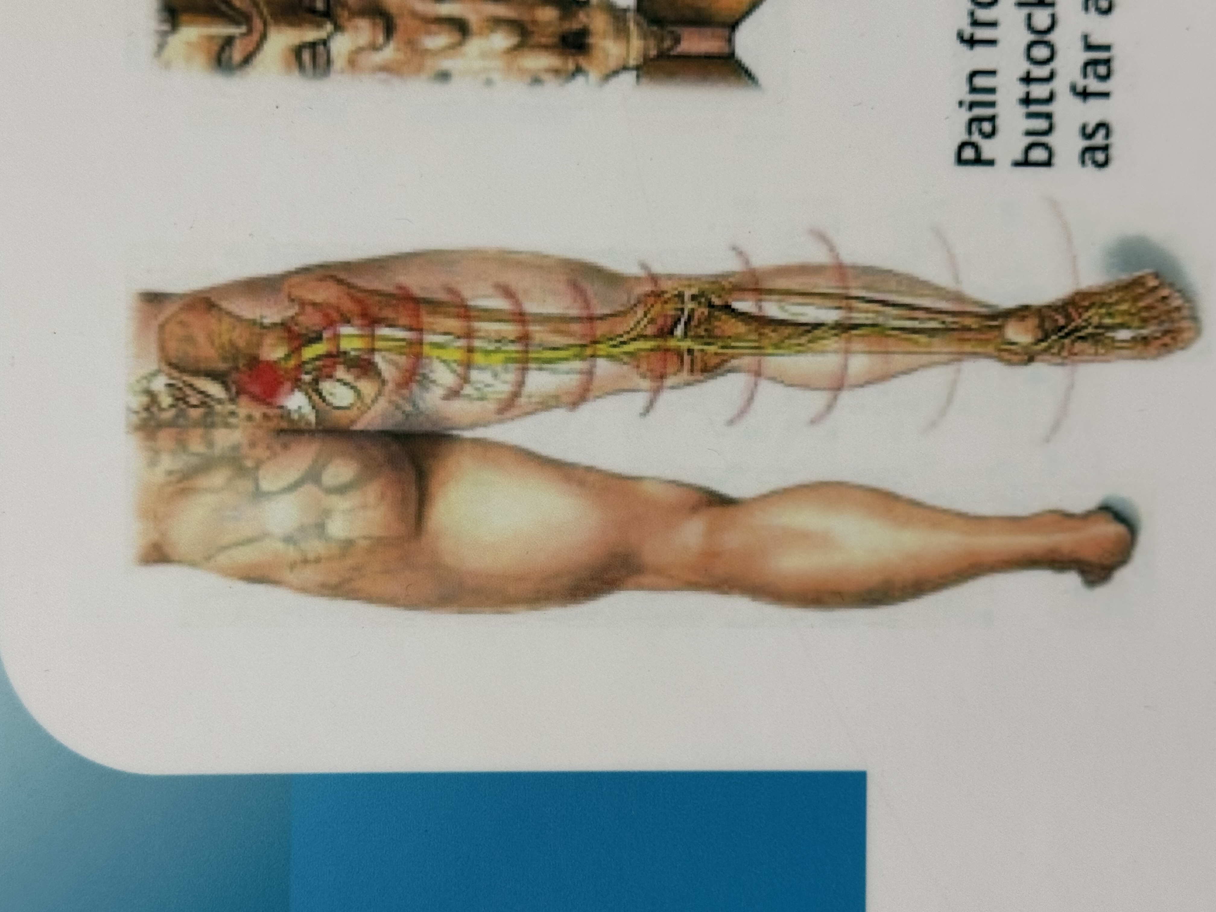 อาการชาที่ขา หลังปวดหลังบ่อยๆ เกิดจากอะไร และอันตรายแค่ไหน?