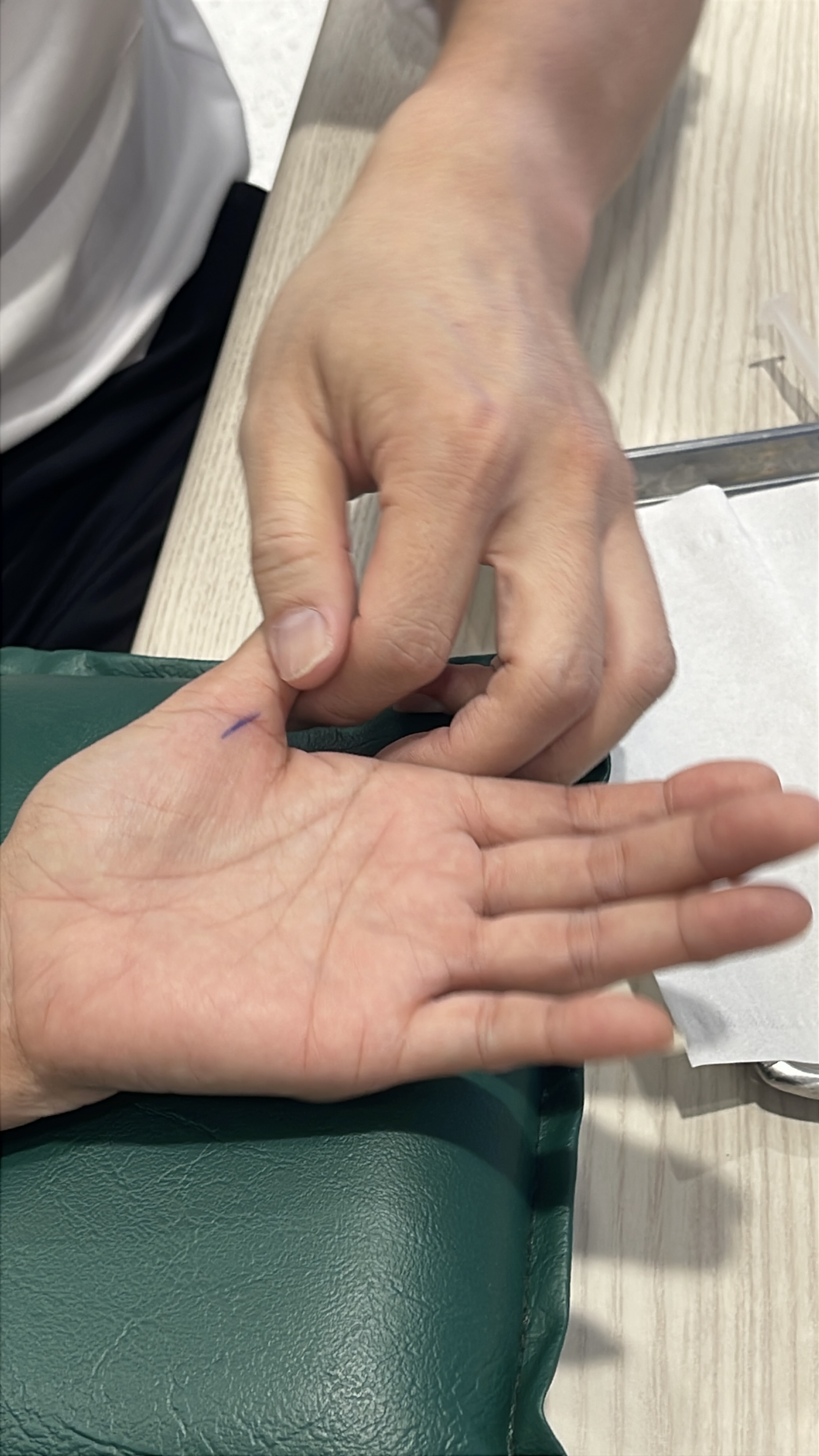 วิธีจัดการ “นิ้วล็อก” (Trigger Finger): ไม่ผ่า ทำอย่างไร?