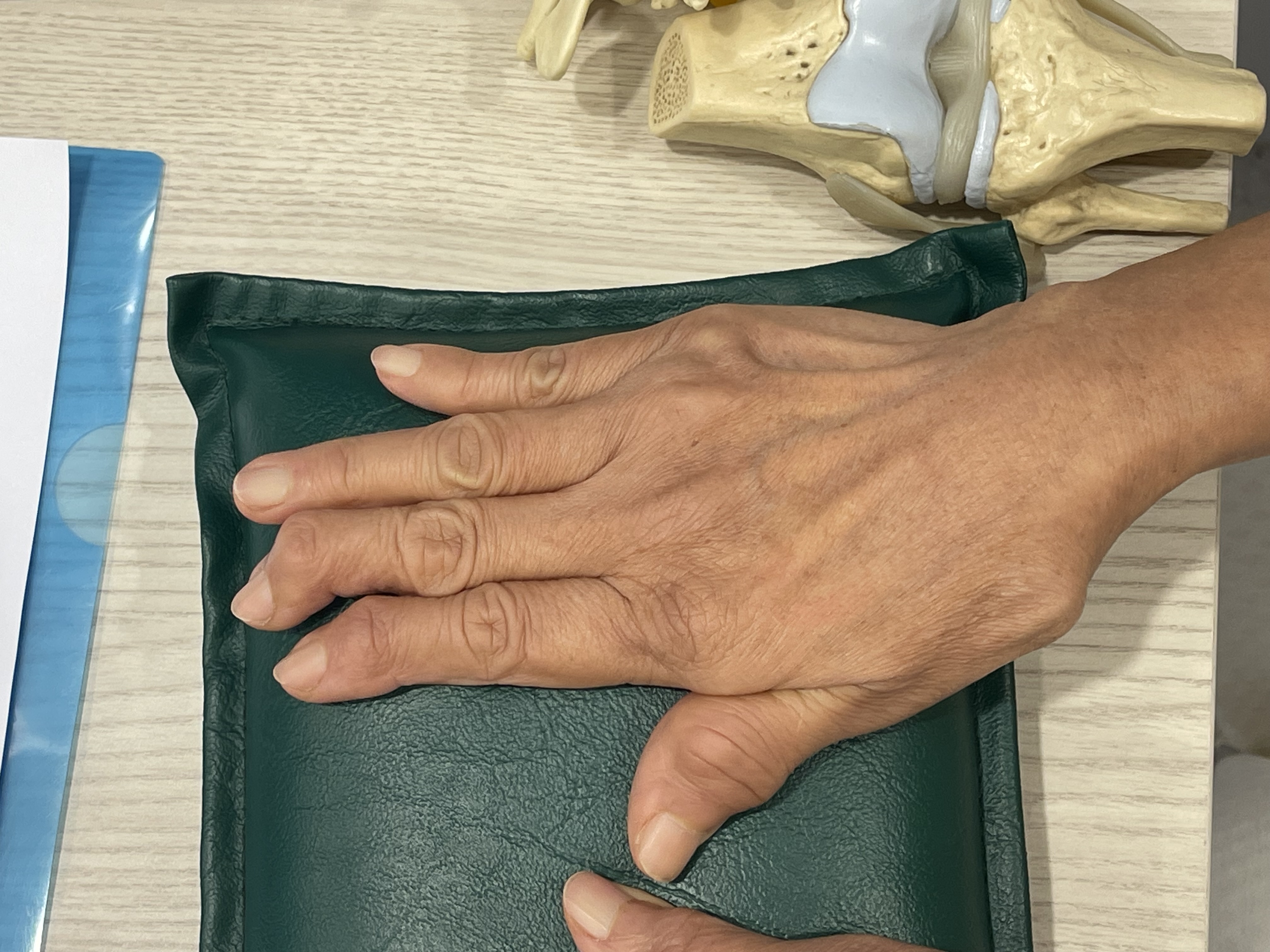 รูมาตอยด์ข้อบวม มือผิดรูป… ทำไมกินยาก็ยังไม่ดีขึ้น?