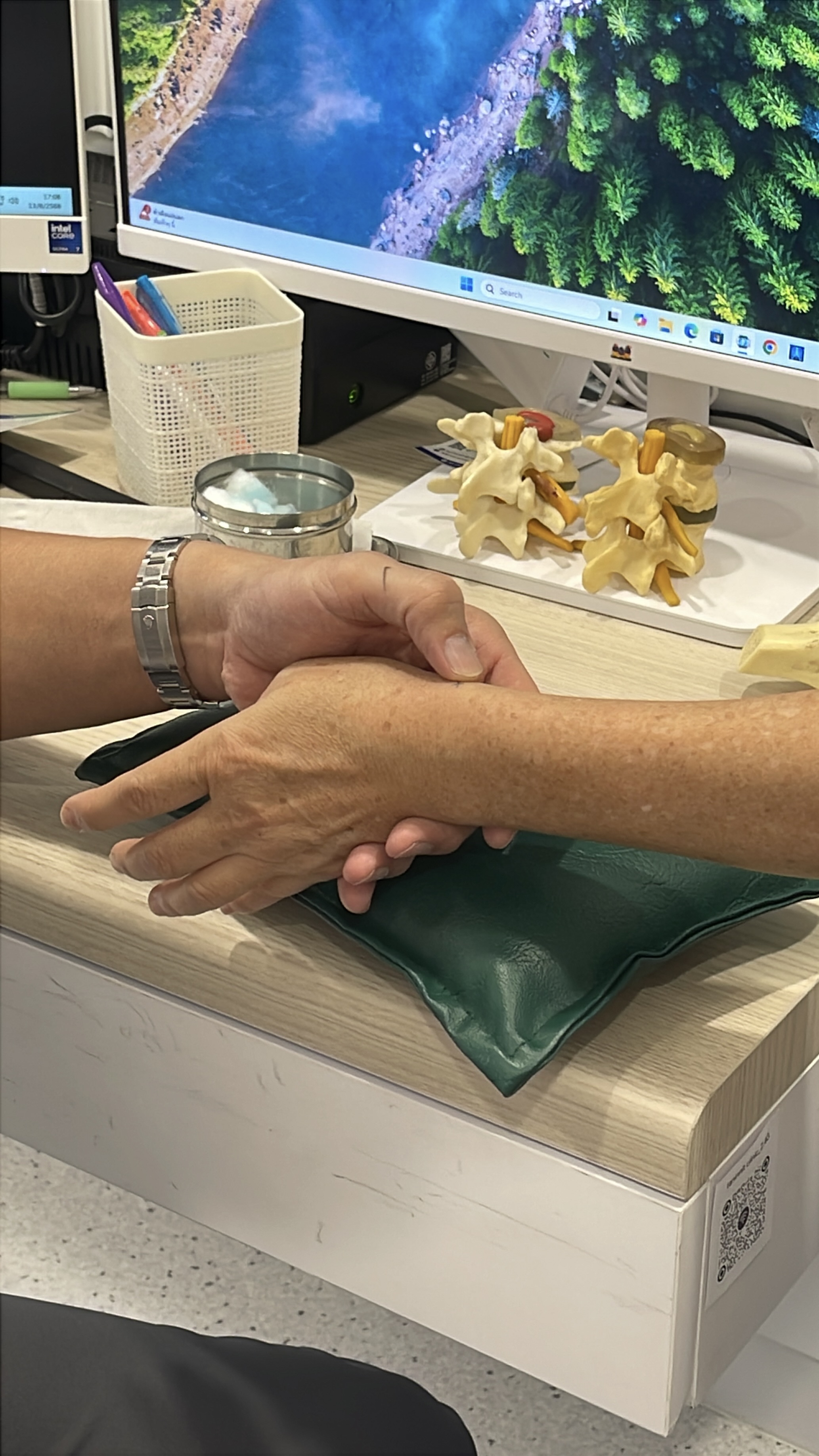 ปวดข้อมือด้านนิ้วโป้ง (De Quervain’s) – รู้จักโรคเอ็นข้อมืออักเสบ