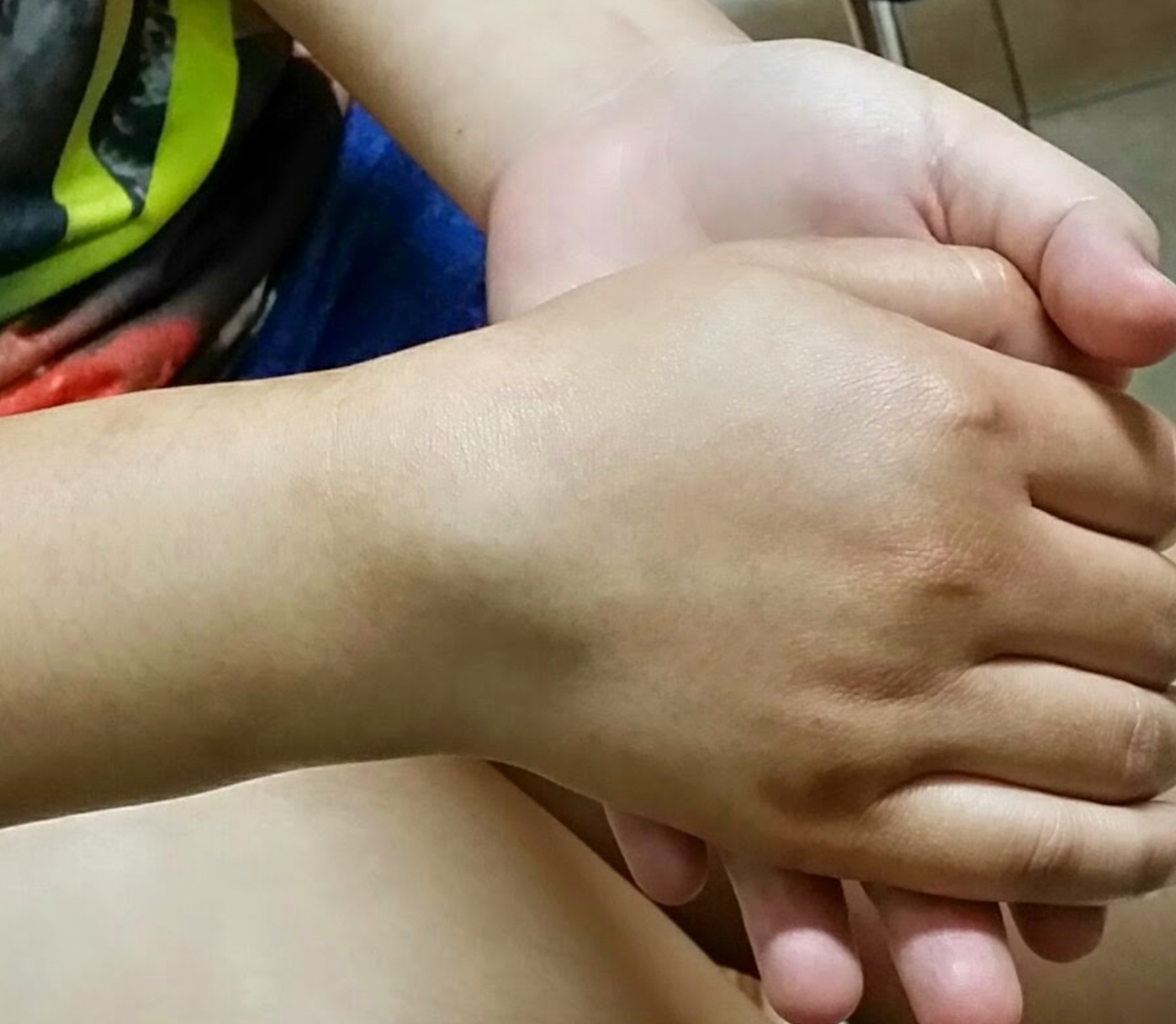 กระดูกข้อมือหัก…ล้มแค่ครั้งเดียว อันตรายกว่าที่คิด