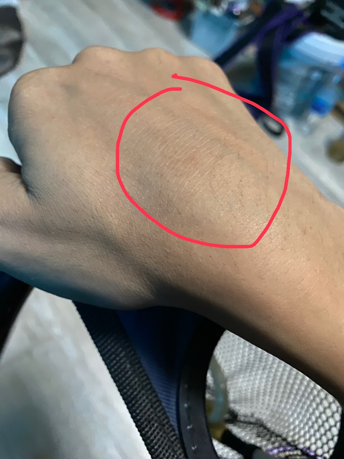 ปวดข้อมือบวม ๆ เป็น ๆ หาย ๆ สัญญาณเตือนอะไรในร่างกาย?