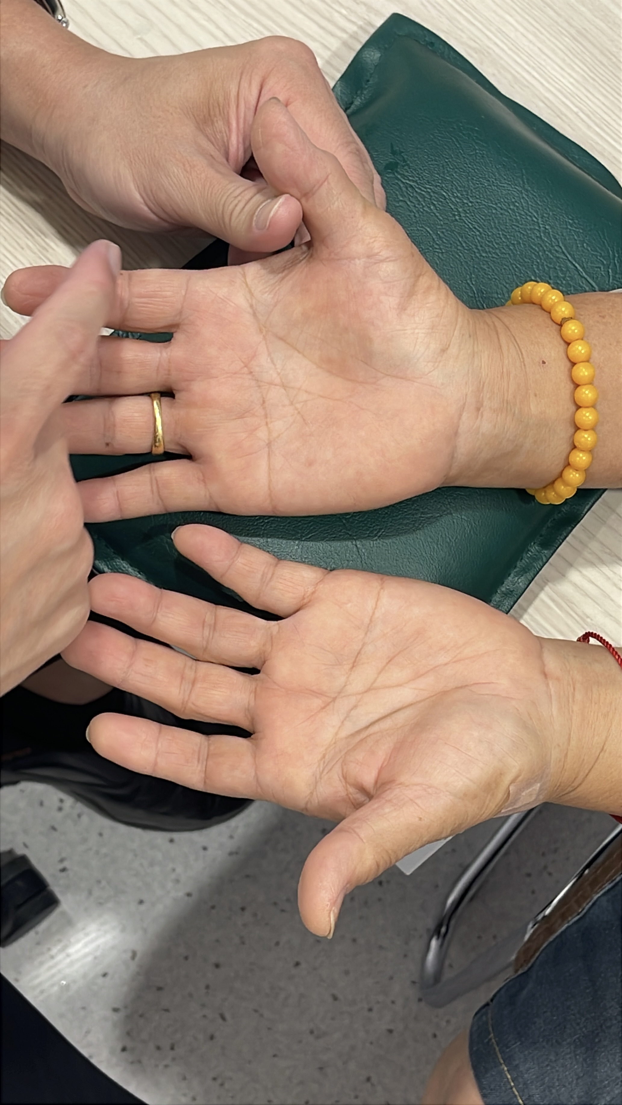 มือชา… เกิดจากกระดูกคอหรือเส้นประสาทข้อมือกันแน่?