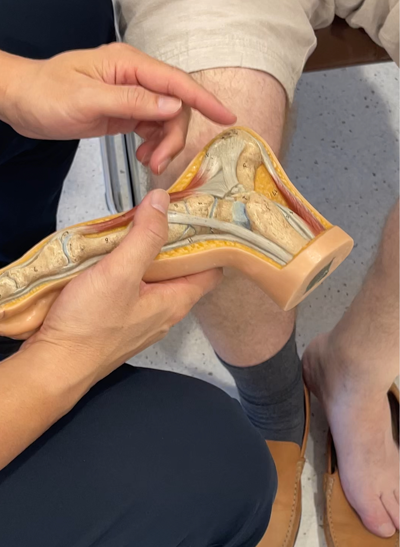 ปวดส้นเท้า ตอนก้าวลงจากเตียงตอนเช้า…ระวัง “โรครองช้ำ” (Plantar Fasciitis)