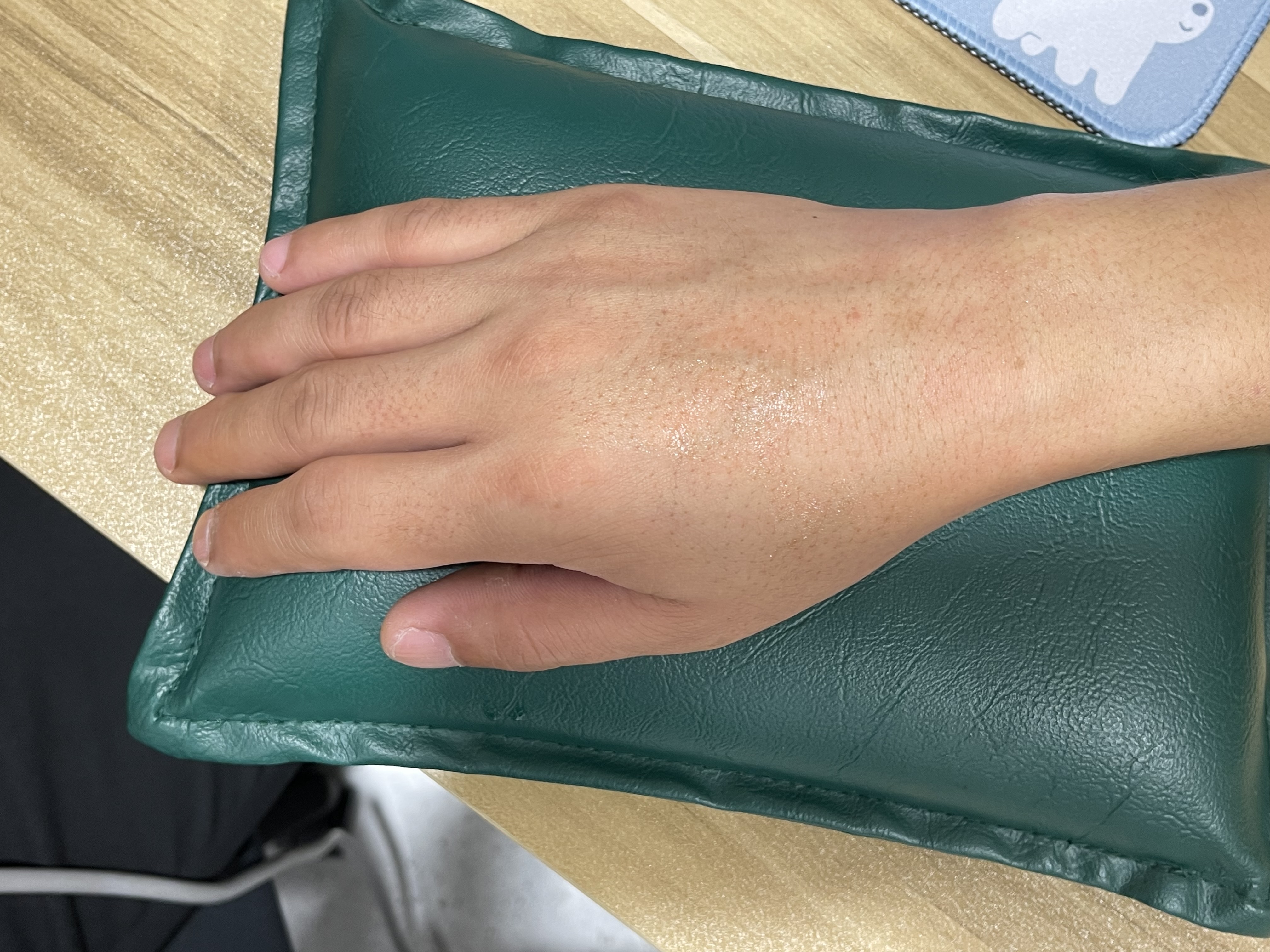 ข้อมือเสื่อมกับเอ็นอักเสบ ต่างกันอย่างไร?