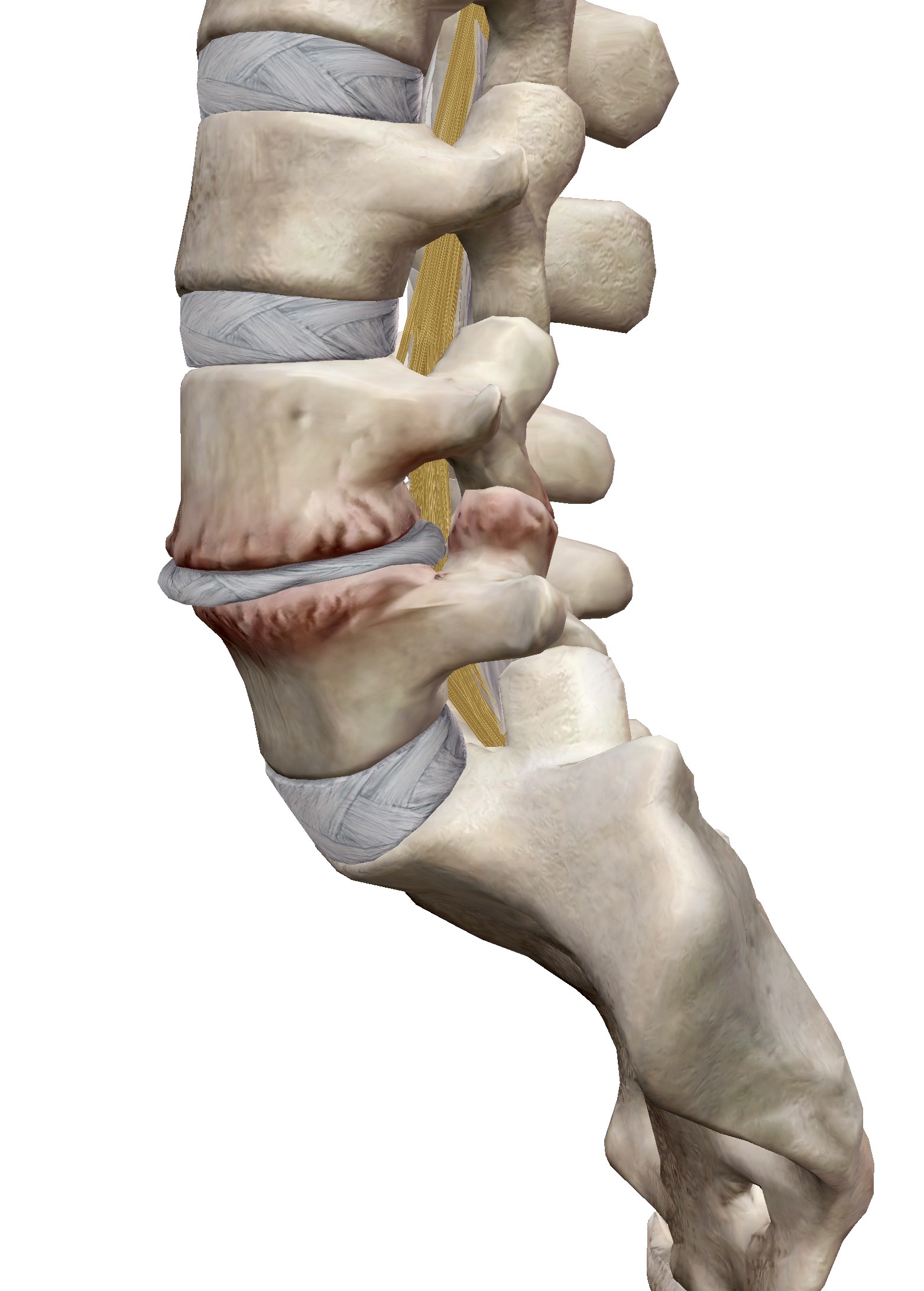 ชะลอการเสื่อมของหมอนรองกระดูก (Degenerative Disc Disease) ทำอย่างไร และข้อห้ามที่ควรรู้