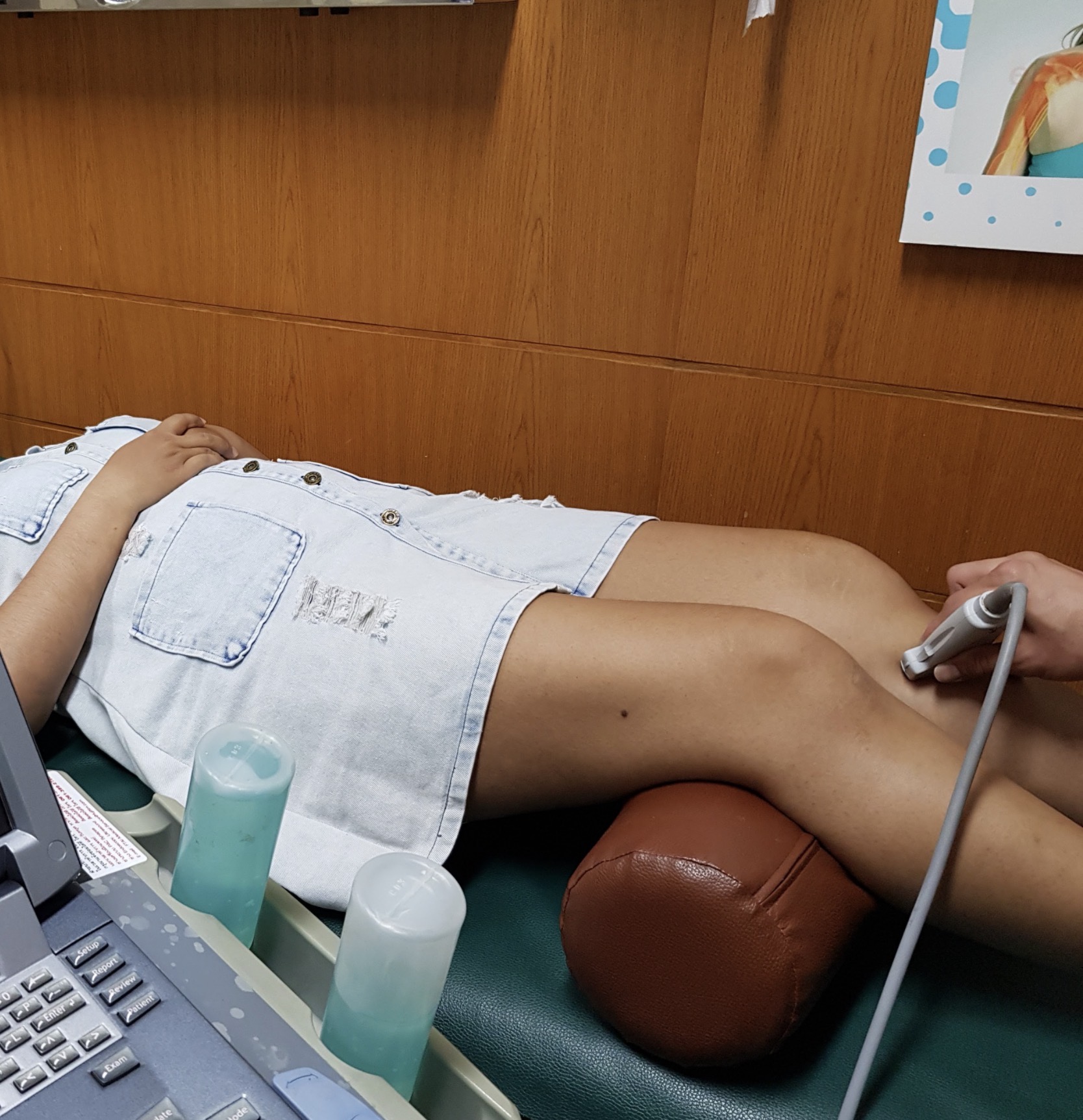 ปวดเข่า เข่าบวม อายุ 30 ปี ทั้งที่ไม่ได้อุบัติเหตุ — เป็นอะไรได้บ้าง?