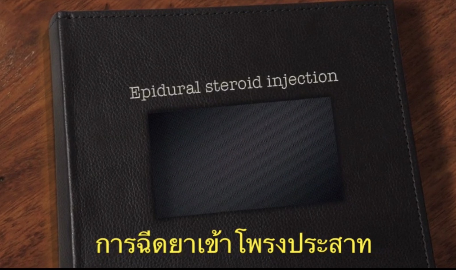 ฉีดยาเข้าโพรงประสาทที่ก้นกบ รักษาอาการปวดหลังแบบไม่ผ่าตัด: เหมาะกับใคร ผลเป็นอย่างไร และต้องทำบ่อยแค่ไหน