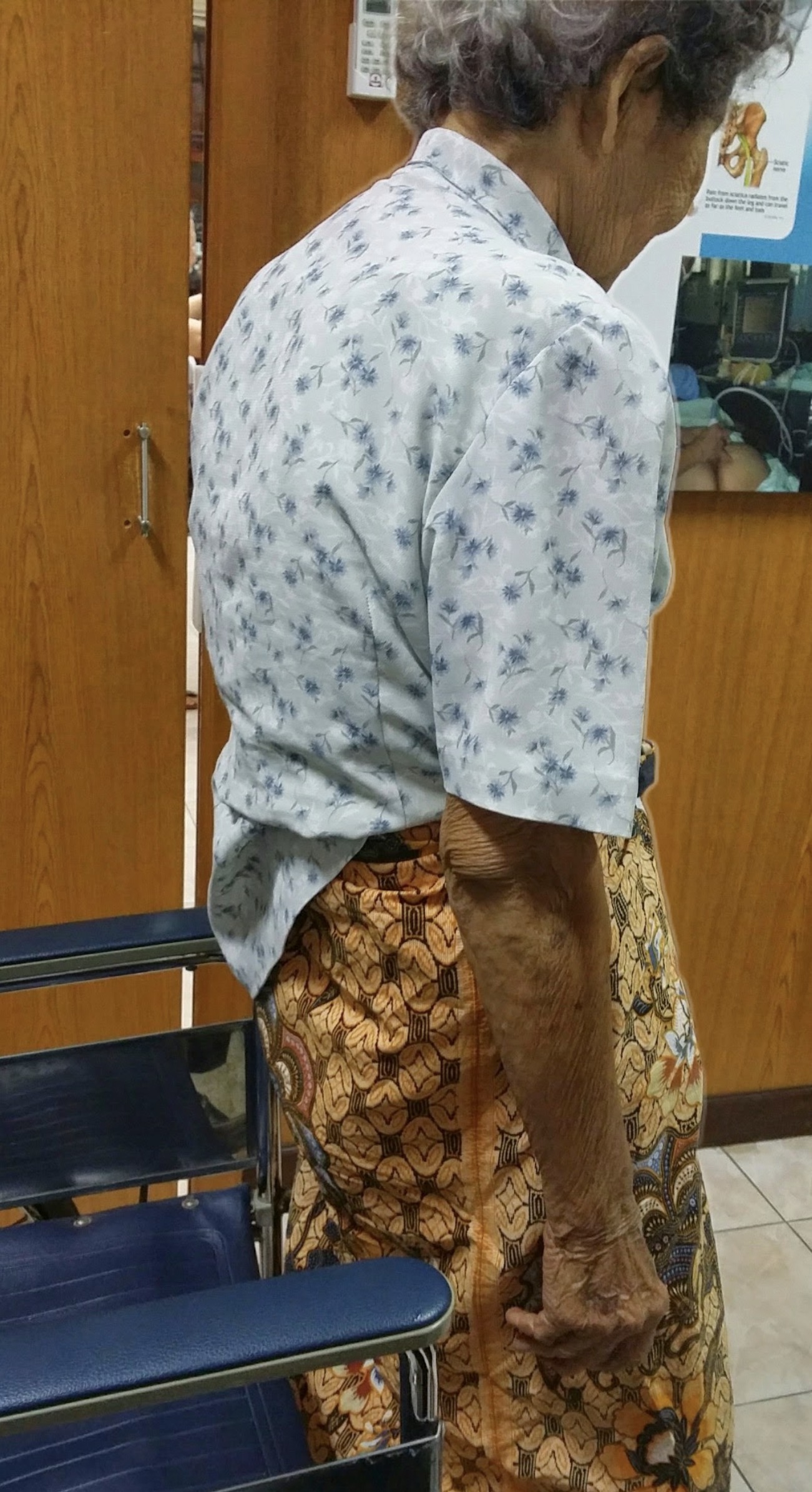 7 วิธีป้องกันกระดูกพรุนตั้งแต่วันนี้ — ทำได้ง่าย ๆ ก่อนกระดูกจะบางแบบไม่รู้ตัว