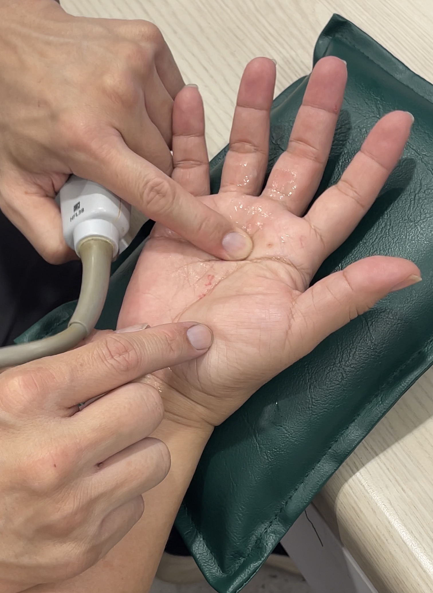 มีก้อนปูดที่โคนนิ้ว! จับแล้วเจ็บ... มันคือ ?