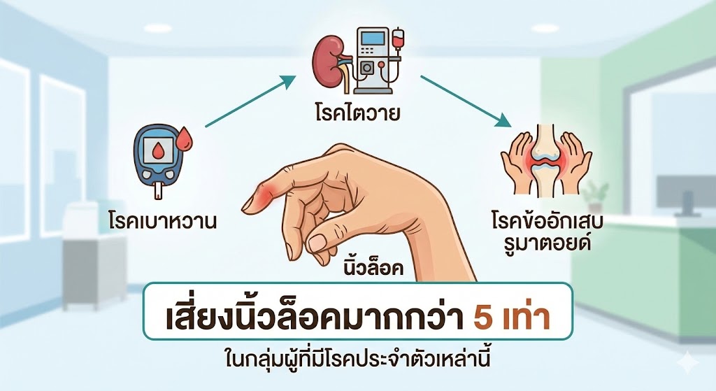 เบาหวาน ไต รูมาตอยด์... ทำไมถึงเสี่ยง "นิ้วล็อค" มากกว่าคนอื่นถึง 5 เท่า?