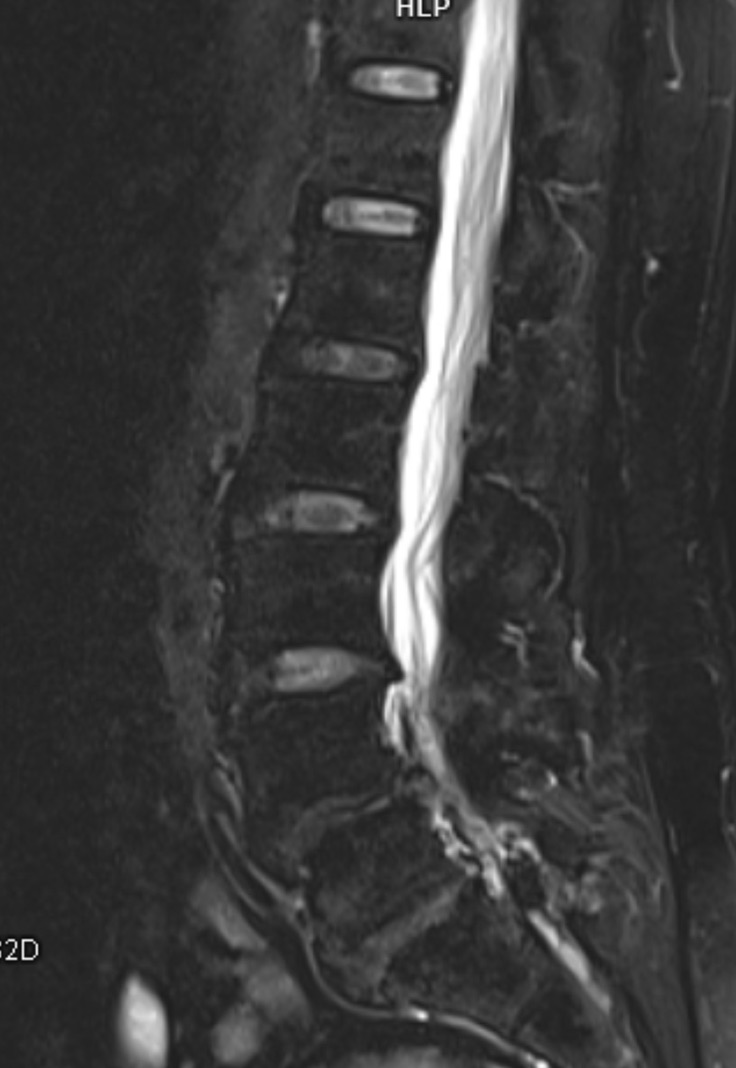 ทำไมบางคน MRI ผิดปกติ แต่ไม่ปวดเลย? ภาพถ่ายไม่ได้บอกทุกอย่างเกี่ยวกับความเจ็บปวด