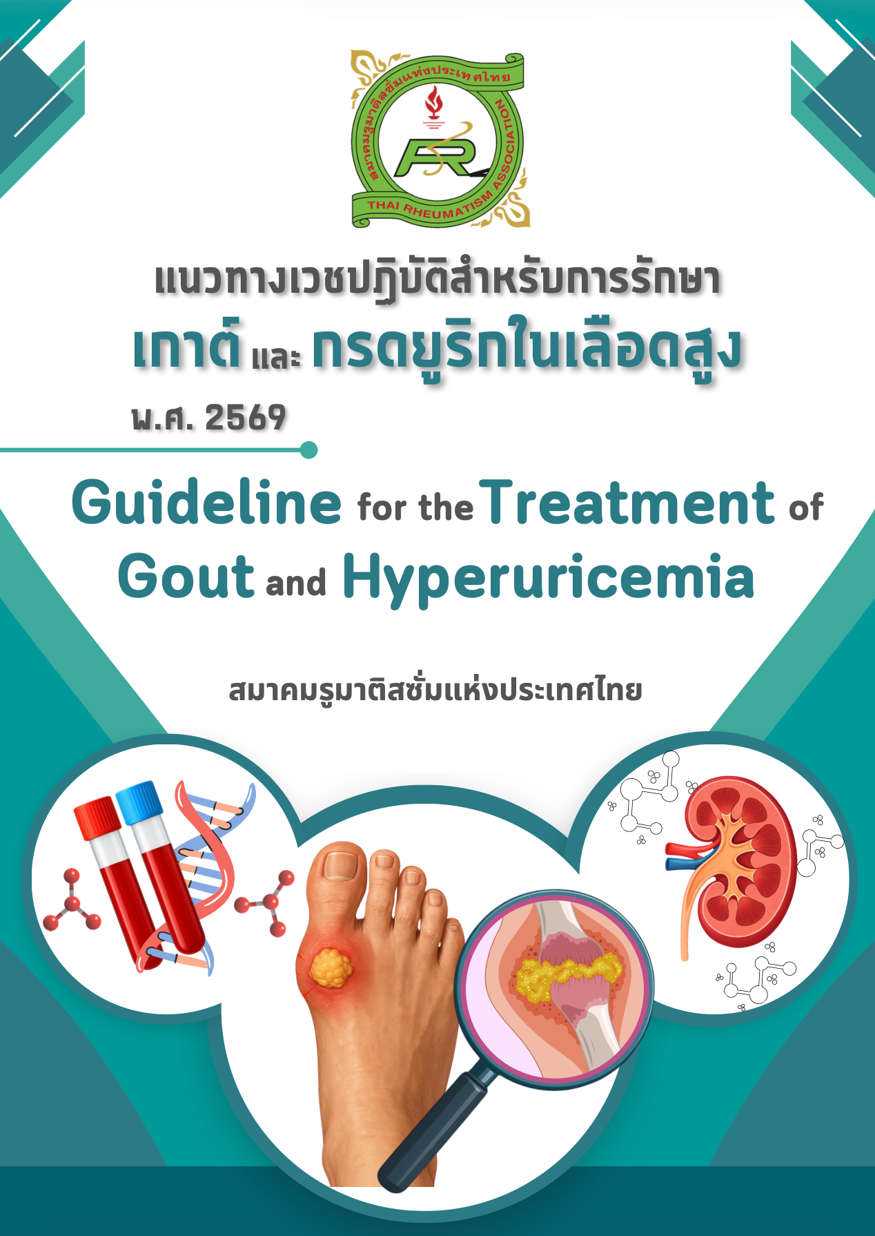 แนวทางเวชปฏิบัติใหม่สำหรับการรักษาโรคเกาต์ พ.ศ. 2569