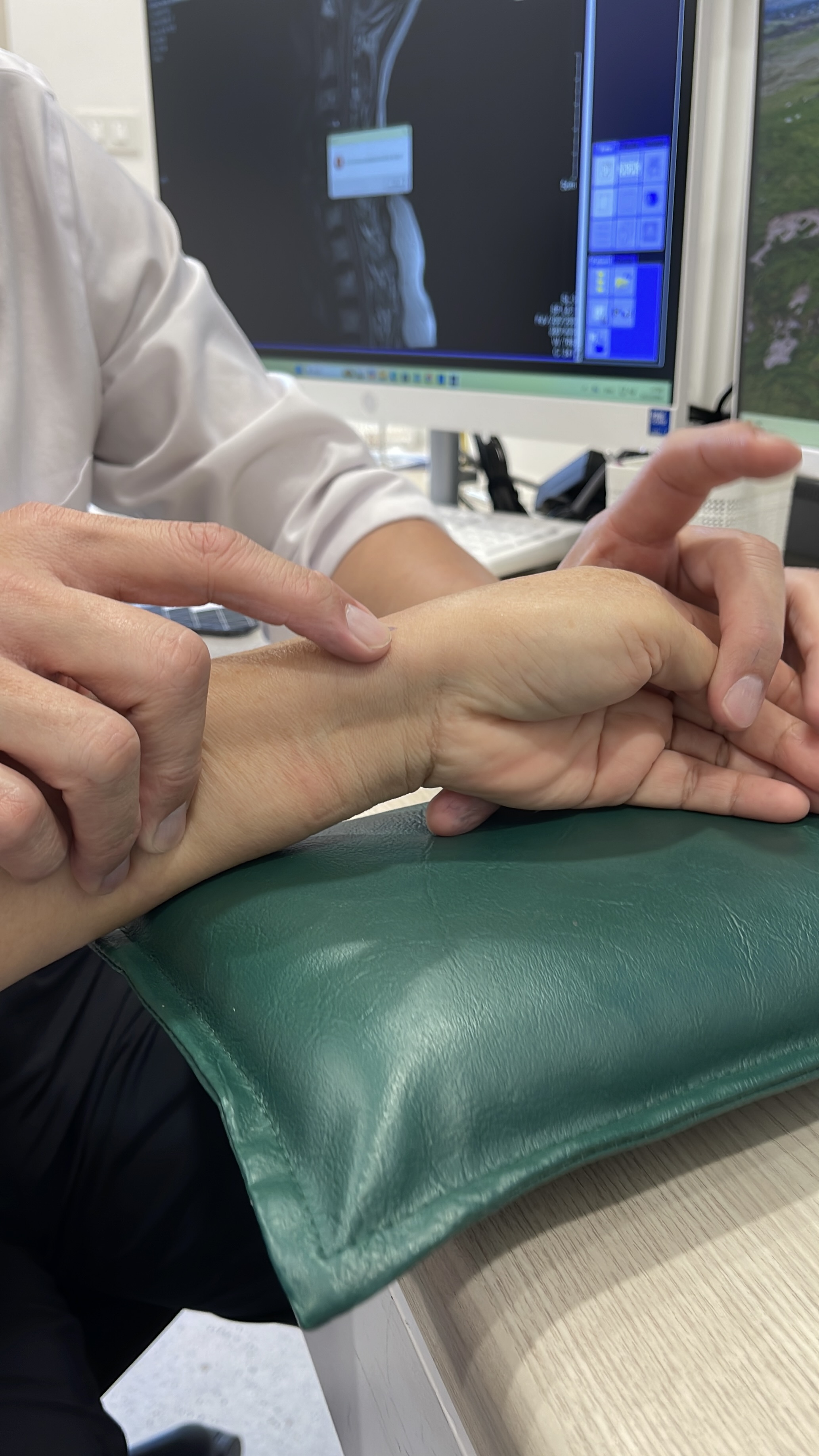 ปวดข้อมือฝั่งหัวแม่มือเรื้อรัง (de Quervain's tenosynovitis) รักษาด้วยเข็มเล็กๆ ภายใต้อัลตราซาวด์ — ทางเลือกใหม่ที่ไม่ต้องผ่าตัด